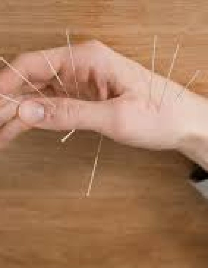 ACUPUNTURA COREANA DAS MÃOS