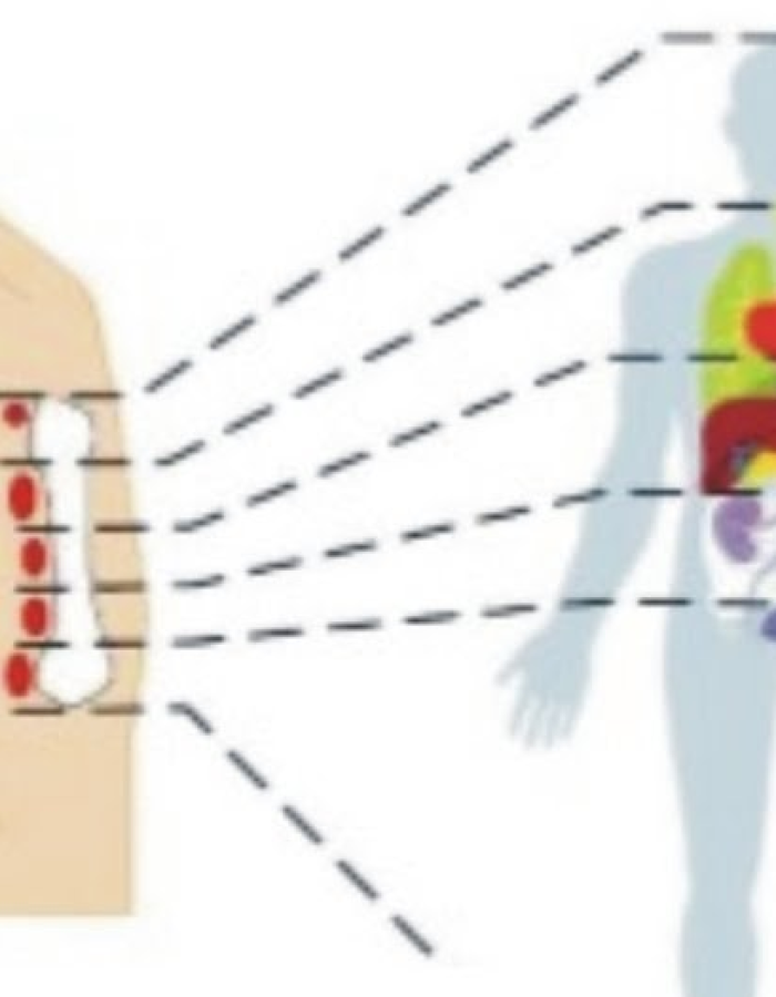 ACUPUNTURA DO 2º METACARPO