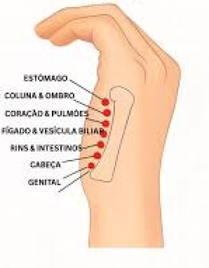 ACUPUNTURA DO 5º METACARPO